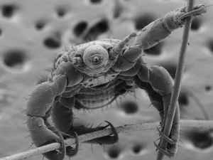 Head lice holding on to hair magnified